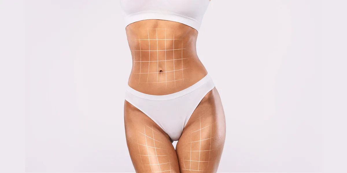 Lazer Liposuction
